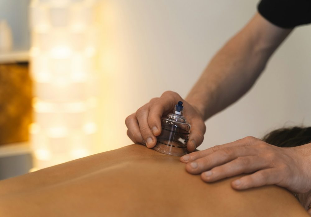 Cupping therapy is being performed on someone's back.