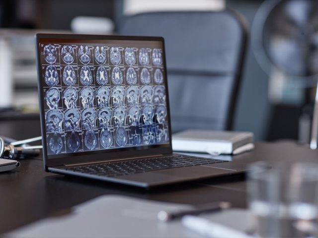 Background shot of neurologists laptop showing computed tomography imaging of human brain on screen resting on conference table in medical office, selective focus, copy space